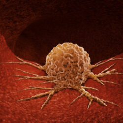 cancer cell - deposit photos